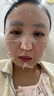 綻妍醫用無(wú)菌敷帖25g*5片項目術(shù)后修護面部修護膜創(chuàng  )面修復面膜 曬單實(shí)拍圖