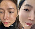 韓方五谷玻尿酸補水噴霧小分子爽膚水377美白補水保濕修護濕敷化妝水禮物 曬單實拍圖