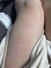 雞皮膚去除神器去雞皮膚毛囊角質(zhì)疙瘩大腿手臂磨砂霜身體乳沐浴露 買(mǎi)2送1【輕度適用】三盒 曬單實(shí)拍圖