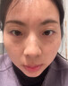 焦博士日本377祛斑霜美白淡化老年黃褐雀斑黑色素熊果苷乳膏去曬男女士 曬單實(shí)拍圖
