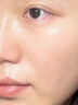 醫用精華液械字號收縮毛孔粗大修復細致去黑頭粉刺閉口男士女士祛痘印黑色素沉淀控油淡化痘印痘坑透明質(zhì)酸鈉 曬單實(shí)拍圖