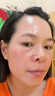 YYTISS377祛斑美白淡斑淡化黑色素藥霜黃褐斑雀斑曬斑女煙酰胺男士專用 曬單實拍圖