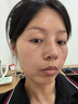 透真左旋vc醫(yī)研美白精華液提亮減黃改善暗沉膚色 377祛斑淡斑抗氧精華 曬單實拍圖