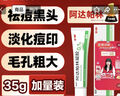 麗芙阿達帕林凝膠35g/盒第三代維a酸乳膏醫用祛痘印修復淡化痘印痘坑修復祛痘藥膏去黑頭收縮毛孔粗大修復 曬單實(shí)拍圖
