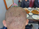 邦泰百靈毛囊炎軟膏頭部專用頭皮癢脂溢性皮炎可搭毛囊炎洗發(fā)水藥監(jiān)備案 曬單實(shí)拍圖