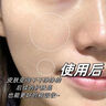 維特絲（vetes）去角質(zhì)面部啫喱控油保濕洗面奶男女士清潔毛孔黑頭閉口溫沒(méi)激素和 【6大專(zhuān)利】果酸去角質(zhì)啫喱200g 曬單實(shí)拍圖