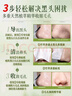 泉兮竹萃祛黑頭三件套去黑頭鼻貼黑頭導(dǎo)出液清理神器收縮毛孔鼻頭貼裝 曬單實(shí)拍圖