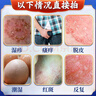 陰囊潮濕瘙癢男人專(zhuān)用止癢去腿根男人下體私處瘙癢睪丸潮濕瘙癢 一盒裝 私處止癢蛋蛋皮瘙癢陰部瘙癢 曬單實(shí)拍圖