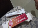 維a酸乳膏去疣醫用去疣膏 扁平疣去疣專(zhuān)用藥 軟化角質(zhì)扁平絲狀疣肉粒疙瘩猴子疣體脫落面部脖子專(zhuān)用 皮膚用藥 1盒【國藥準字疣類(lèi)藥膏】 曬單實(shí)拍圖