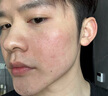 儒意（RUYI）硫磺洗面奶500g 男女士控油祛痘除螨蟲(chóng)去黑頭亮膚氨基酸洗潔面乳 曬單實(shí)拍圖