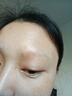 邦臣（BANGCHEN）308白癜風(fēng)治療儀光療儀醫院紫外線(xiàn)燈同款家用銀屑病窄譜nbuvb激光 【強度20/面積3 】基礎款UV308A1 曬單實(shí)拍圖