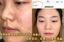 儒意（RUYI）硫磺洗面奶500g 男女士控油祛痘除螨蟲去黑頭亮膚氨基酸洗潔面乳 曬單實拍圖
