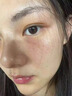 醫用精華液械字號收縮毛孔粗大修復細致去黑頭粉刺閉口男士女士祛痘印黑色素沉淀控油淡化痘印痘坑透明質(zhì)酸鈉 曬單實(shí)拍圖