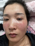 Aromat Herbs澳洲進(jìn)口美白祛斑乳液377煙酰胺去黃提亮滋潤補水保濕護膚品套裝 【美白淡斑】乳液+水+面霜+精華 曬單實(shí)拍圖
