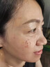 萊覽奧蓋祛斑霜祛斑黃褐斑雀斑曬斑男女士用的純中藥老年斑專(zhuān)用非藥一夜消 特效：拍1發(fā)3【日本原裝進(jìn)口】 醫用正品美白淡化黑色素老人斑臉部手背效果最好純中藥 曬單實(shí)拍圖