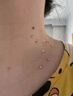 刺猴專(zhuān)用非藥肉粒疙瘩拓疣雞眼魚(yú)鱗痣扁平疣肉刺手腳脖子通用液體敷料膏 1盒裝（輕微癥狀） 曬單實(shí)拍圖