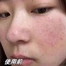 維特絲（vetes）去角質(zhì)面部啫喱控油保濕洗面奶男女士清潔毛孔黑頭閉口溫沒(méi)激素和 【6大專(zhuān)利】果酸去角質(zhì)啫喱200g 曬單實(shí)拍圖