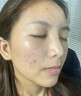 韓方五谷壬二酸祛痘膏膠態(tài)硫凝膠去痘痘淡印痘坑水楊酸祛痘青春期學(xué)生專(zhuān)用 曬單實(shí)拍圖