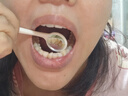 康佳（KONKA）超聲波潔牙器洗牙器結石去清除潔洗牙齒沖洗器去黃牙結石神清潔器煙漬茶漬工具醫(yī)用七夕情人節(jié)禮物 星空藍95%選擇【真超聲波醫(yī)療器械認證】 4支噴頭 曬單實拍圖