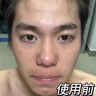 SKISGEM德國進(jìn)口除螨蟲(chóng)祛痘氨基酸洗面奶控油男女士去黑頭縮毛孔潔面乳 洗面奶200g【加強版：深入毛孔改善痘肌】 曬單實(shí)拍圖