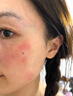 美顏坊曬后修復面膜舒緩泛紅敏感肌醫美用防曬傷急救白修護屏障受損15片 曬單實(shí)拍圖