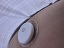 三諾（Sinocare）愛(ài)看動(dòng)態(tài)血糖儀二代i6免扎針免校準15天持續葡萄糖監測系統4盒裝 曬單實(shí)拍圖