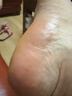 傾姿堂腳氣噴劑止癢脫皮爛腳丫真菌感染去水泡型腳汗腳臭專(zhuān)用噴霧35ML 曬單實(shí)拍圖