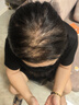 韓方五谷防脫育發(fā)液固發(fā)營養(yǎng)增長液發(fā)際線生長液長發(fā)劑頭皮精華 曬單實拍圖
