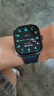 小米（MI）REDMI Watch 5 典雅黑 國家補貼 澎湃OS 2 心率血氧監測 藍牙通話(huà) 紅米手表5 智能手表 小米汽車(chē) 曬單實(shí)拍圖