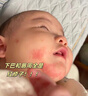 Masata新加坡進(jìn)口水膏嬰兒唇周膏新生兒護理膏嘴部疹寶寶嬰幼兒專(zhuān)用20g 曬單實(shí)拍圖