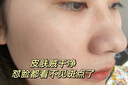 SEEDONVEUR美白祛斑霜淡化黑色素去斑霜雀斑黃褐斑老年斑曬斑煙酰胺凝膠 20g 曬單實(shí)拍圖
