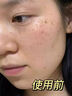 泊紫汀蘭377美白祛斑霜淡化黑色素去雀斑黃褐斑提亮改善暗沉保濕面霜乳液 曬單實拍圖
