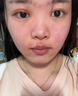 Newliann醫用重組三型人源化膠原蛋白乳液修復敷料凝膠人表皮生長(cháng)因子面霜 曬單實(shí)拍圖