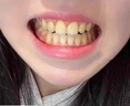 CNDK牙齒炫白牙斑凈洗牙液去黑牙黃牙煙牙白牙美潔牙粉口氣清新洗牙粉 三盒 曬單實(shí)拍圖