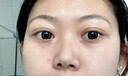 dyey祛痣點痣膏無痕臉部黑痣扁I平疣痦子瘊子祛斑點斑非薬水面部專用 曬單實拍圖