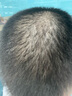 【第二代米諾地爾】蔓迪5%生發(fā)泡沫劑60g（倍速生發(fā) 溫和不起痘）男女士專(zhuān)用治脫發(fā)防脫育發(fā)米洛原液酊搽劑 曬單實(shí)拍圖
