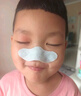 村崎制藥日本蒼耳子舒鼻貼鼻炎貼兒童通氣鼻貼通鼻神器流鼻涕鼻塞鼻干癢 曬單實(shí)拍圖