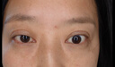 丁達爾達爾多肽眼霜咖啡因緊致煥亮達達多肽眼霜淡化細紋達爾眼霜 三支周期裝【98%用戶(hù)選擇】 曬單實(shí)拍圖
