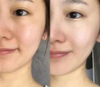 維特絲377面霜乳液美白淡斑保濕補水男女水乳抗皺緊致淡化黑色素護膚品 曬單實(shí)拍圖
