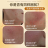 向美博士硫磺洗面奶潔面控油祛痘除螨蟲去黑頭粉刺收縮毛孔男士專用潔面乳 第2瓶3折【日常清潔控油除螨】 曬單實(shí)拍圖