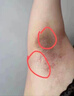 喬記腋下黑色素去除胳肢窩美白脖子腋下大腿內側黑棘皮病去除非藥乳膏 1盒凈化素【無(wú)試用無(wú)買(mǎi)贈】 私處粉嫩淡化黑色素黑棘皮病輔助治療脖子黑色素膏藥 曬單實(shí)拍圖