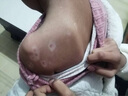 邦臣（BANGCHEN）308白癜風(fēng)治療儀光療儀家用醫院紫外線(xiàn)燈同款銀屑病窄譜nbuvb激光 【強度25/面積4】溫和款UV308B1 曬單實(shí)拍圖
