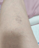 舒爾美  醫用彈力襪男女通用靜脈曲張 二級壓力連褲襪 膚色露趾 M 曬單實(shí)拍圖