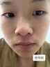 Newliann醫用重組三型人源化膠原蛋白乳液修復敷料凝膠人表皮生長(cháng)因子面霜 曬單實(shí)拍圖