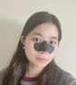 溫博士去黑頭鼻貼10組20片黑頭貼清理神器導(dǎo)出液草莓鼻收縮毛孔男女士 曬單實拍圖