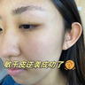 Newliann醫(yī)用重組三型人源化膠原蛋白乳液修復(fù)敷料凝膠人表皮生長(zhǎng)因子面霜 曬單實(shí)拍圖