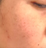 極萌【丁禹兮同款】水光儀抗衰補水收縮毛孔自打儀器美容儀生日禮物送女友原液-毛孔收縮彈 曬單實(shí)拍圖