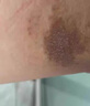 香港大藥房有限公司大腿根內測陰囊潮濕男人屁股肛門(mén)瘙癢止癢專(zhuān)用去根搭藥膏周 曬單實(shí)拍圖