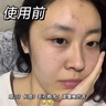 維特絲（vetes）去角質(zhì)面部啫喱控油保濕洗面奶男女士清潔毛孔黑頭閉口溫沒(méi)激素和 【6大專(zhuān)利】果酸去角質(zhì)啫喱200g 曬單實(shí)拍圖