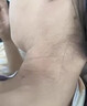 神經(jīng)性皮炎專(zhuān)用藥頑固特癥效藥皮膚瘙癢皮炎濕疹真菌感染過(guò)敏皮癬止癢100%特新期效皮膚用藥曲咪新乳膏 1盒【神經(jīng)性皮炎 皮膚紅斑瘙癢】100%止癢 曬單實(shí)拍圖